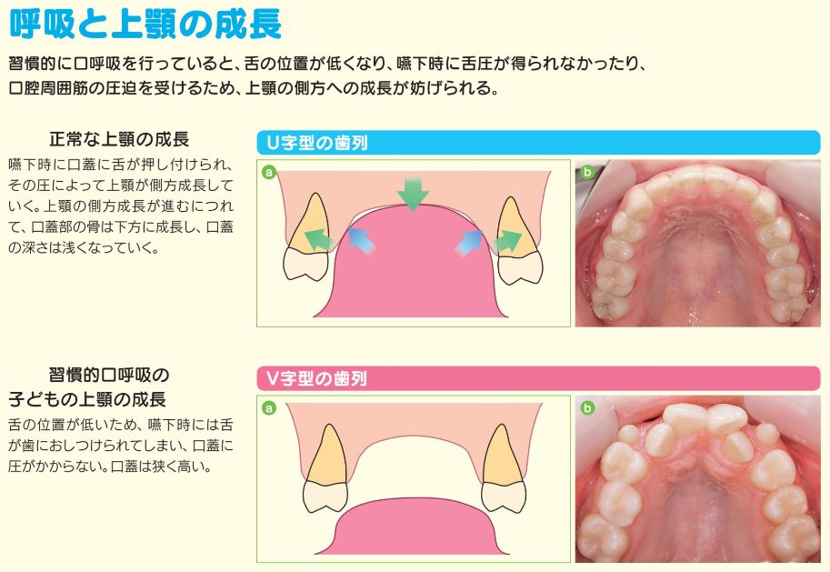 はじめましょう お口のトレーニング デンタル オフィス ケイ スタッフ ブログ